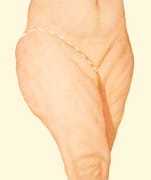 Lateral thigh lift incisions