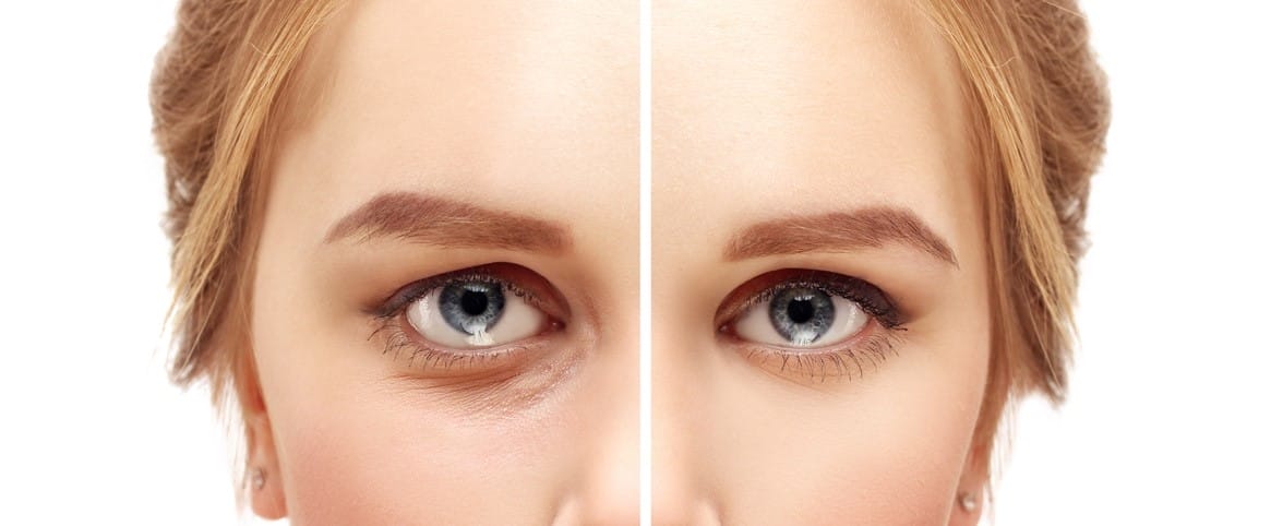 Featured image for “9 Ways Your Face Changes as You Age”