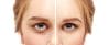 9 Ways Your Face Changes as You Age