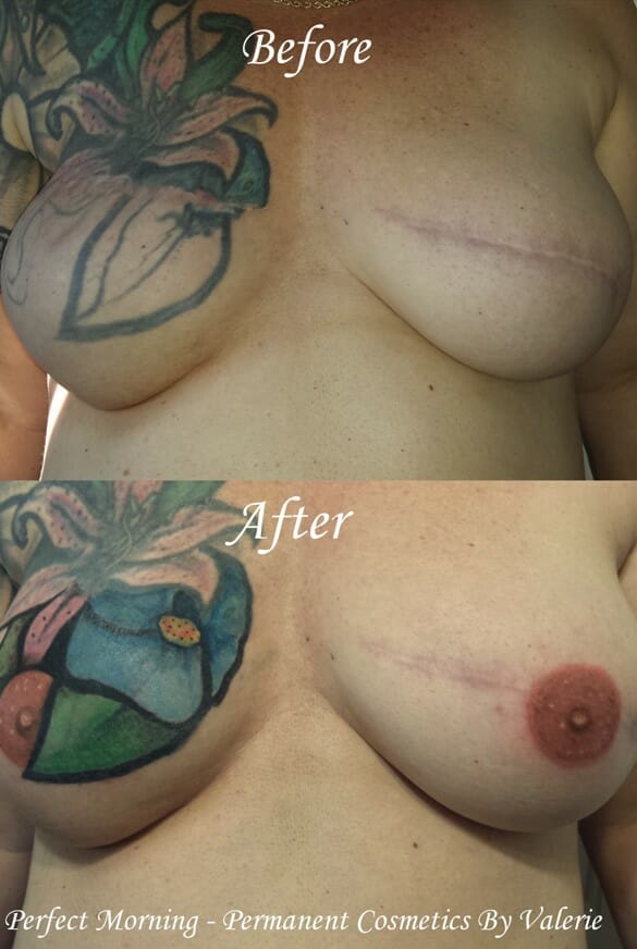 Nipple Areolar Tattoo