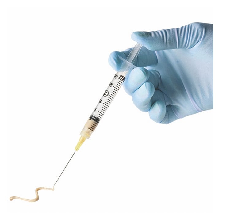 Renuva injection by Dr. Thomassen