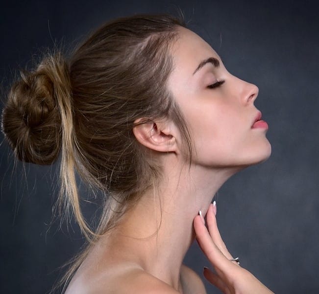 Neck Liposuction Results by Dr. Thomassen