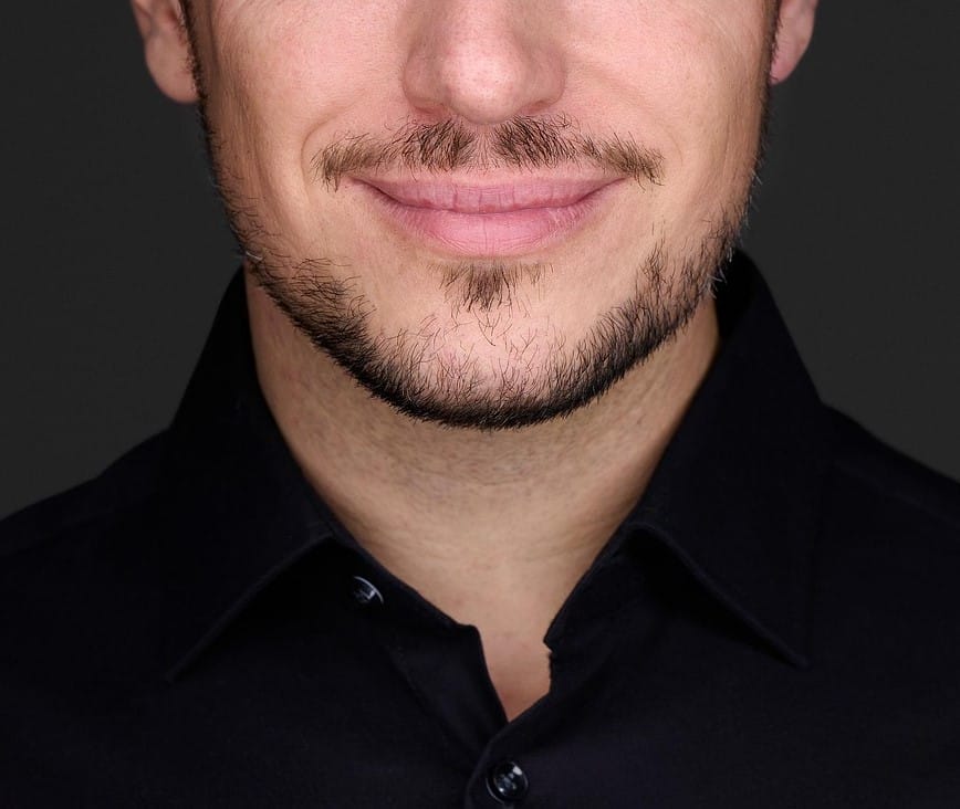 Male facelift in fort lauderdale